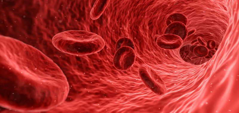 Vascular dementia and red blood cells